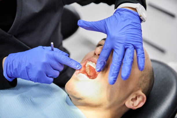 Best Broken or Chipped Tooth Repair in Weston Mills, NY